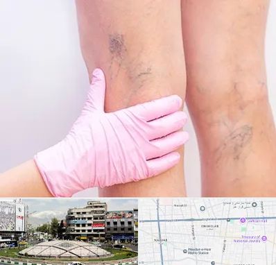 دکتر فوق تخصص واریس در مرکز تهران