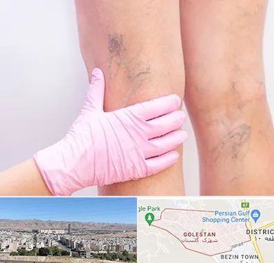 دکتر فوق تخصص واریس در شهرک گلستان شیراز 