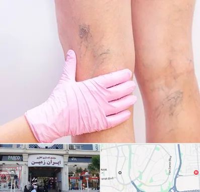 دکتر فوق تخصص واریس در ایران زمین