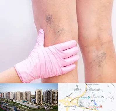 دکتر فوق تخصص واریس در المپیک 