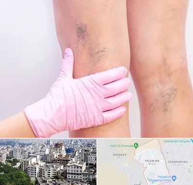 دکتر فوق تخصص واریس در ولنجک 