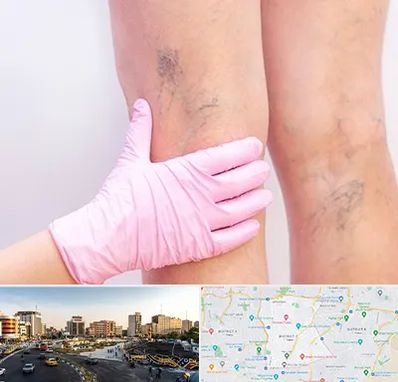 دکتر فوق تخصص واریس در منطقه 7 تهران 