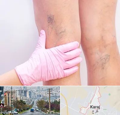 دکتر فوق تخصص واریس در گوهردشت کرج 