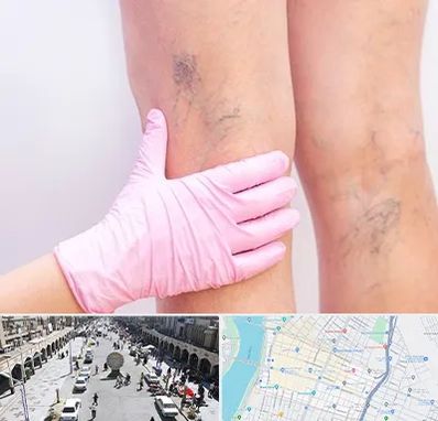 دکتر فوق تخصص واریس در نادری اهواز 