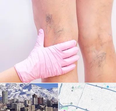 دکتر فوق تخصص واریس در ازگل