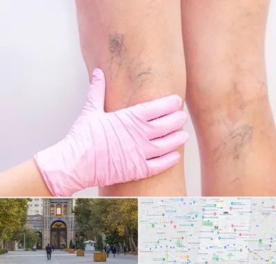 دکتر فوق تخصص واریس در منطقه 12 تهران 