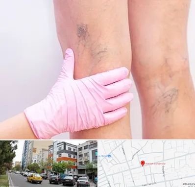 دکتر فوق تخصص واریس در هفده شهریور تبریز