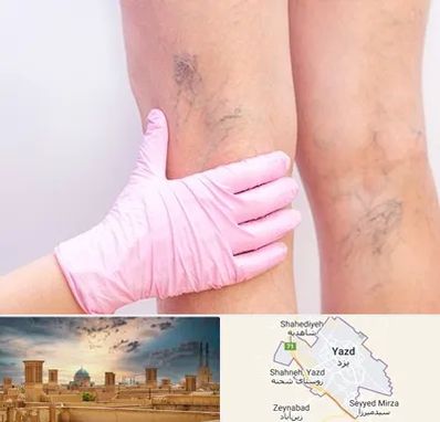 دکتر فوق تخصص واریس در یزد