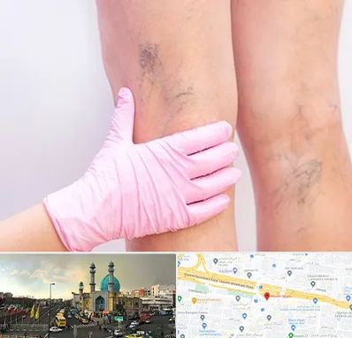 دکتر فوق تخصص واریس در رسالت 