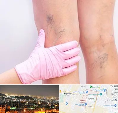 دکتر فوق تخصص واریس در مارلیک کرج 