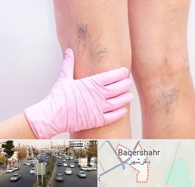 دکتر فوق تخصص واریس در باقرشهر