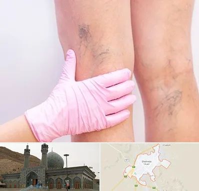 دکتر فوق تخصص واریس در شهرضا