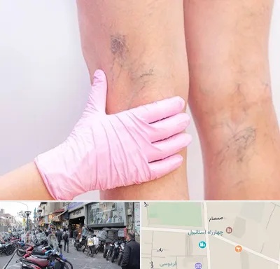 دکتر فوق تخصص واریس در چهارراه استانبول