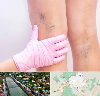 دکتر فوق تخصص واریس در مراغه