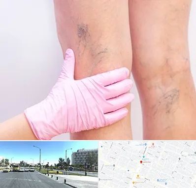 دکتر فوق تخصص واریس در بلوار کلاهدوز مشهد 