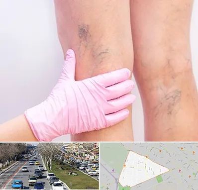 دکتر فوق تخصص واریس در احمدآباد مشهد 