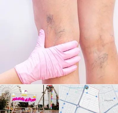 دکتر فوق تخصص واریس در پادادشهر اهواز