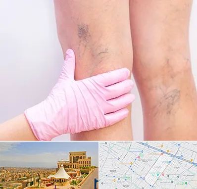 دکتر فوق تخصص واریس در هاشمیه مشهد 