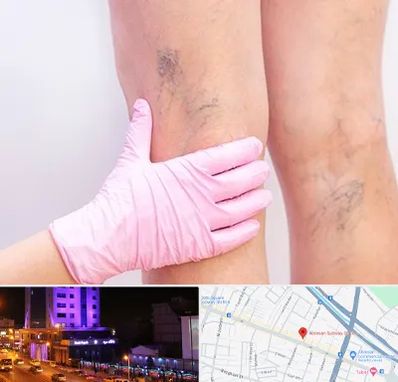 دکتر فوق تخصص واریس در آبرسان تبریز