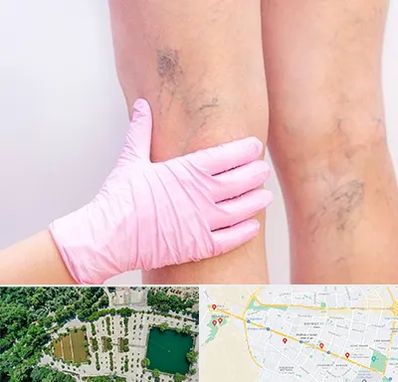 دکتر فوق تخصص واریس در وکیل آباد مشهد 