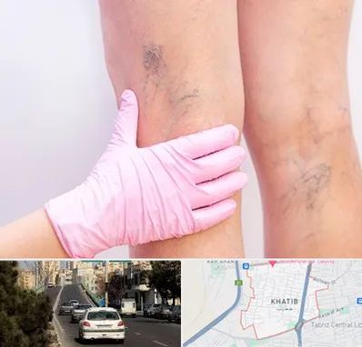 دکتر فوق تخصص واریس در خطیب تبریز