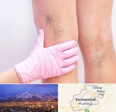 دکتر فوق تخصص واریس در کرمانشاه