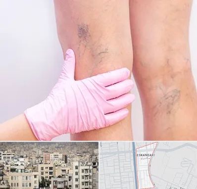 دکتر فوق تخصص واریس در اسکندری