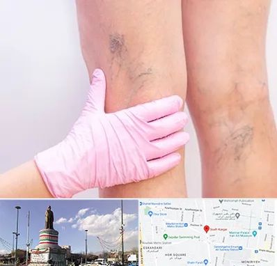 دکتر فوق تخصص واریس در کارگر جنوبی 