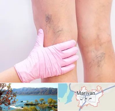 دکتر فوق تخصص واریس در مریوان