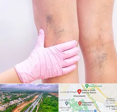 دکتر فوق تخصص واریس در قصرالدشت شیراز 