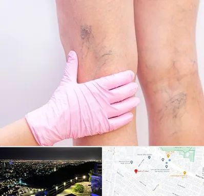 دکتر فوق تخصص واریس در هفت تیر مشهد 