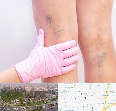 دکتر فوق تخصص واریس در آیت الله کاشانی