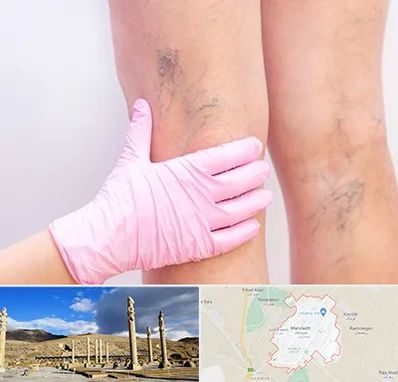 دکتر فوق تخصص واریس در مرودشت