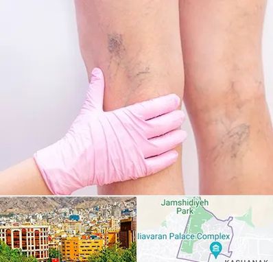 دکتر فوق تخصص واریس در نیاوران 