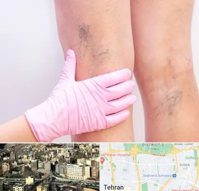 دکتر فوق تخصص واریس در مرزداران 