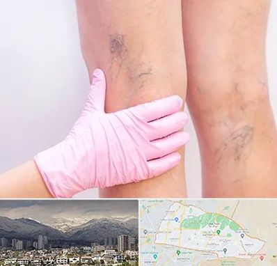 دکتر فوق تخصص واریس در منطقه 4 تهران 