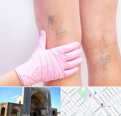 دکتر فوق تخصص واریس در مصلی مشهد