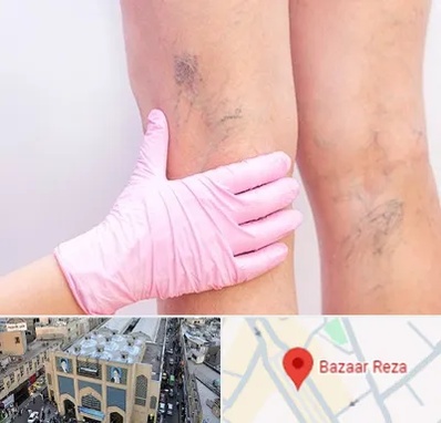 دکتر فوق تخصص واریس در بازار رضا مشهد