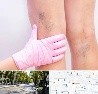 دکتر فوق تخصص واریس در میرداماد 