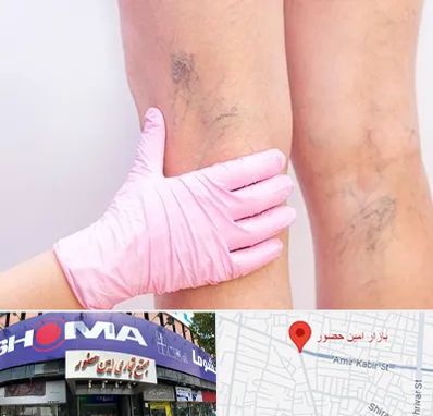 دکتر فوق تخصص واریس در امین حضور