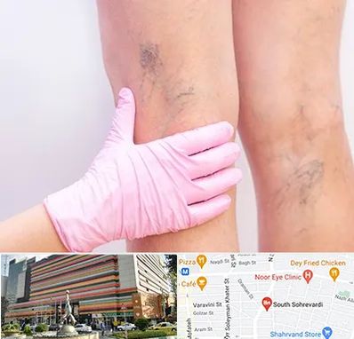 دکتر فوق تخصص واریس در سهروردی 