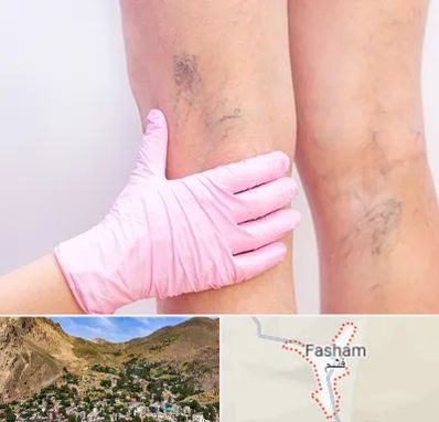 دکتر فوق تخصص واریس در فشم