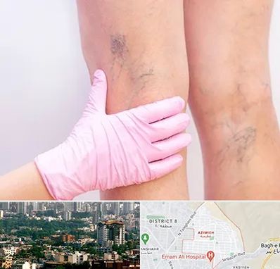 دکتر فوق تخصص واریس در عظیمیه کرج 