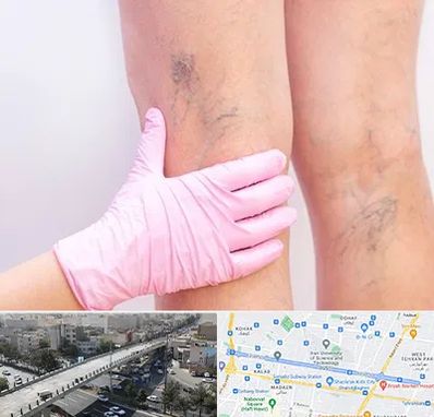 دکتر فوق تخصص واریس در فرجام 