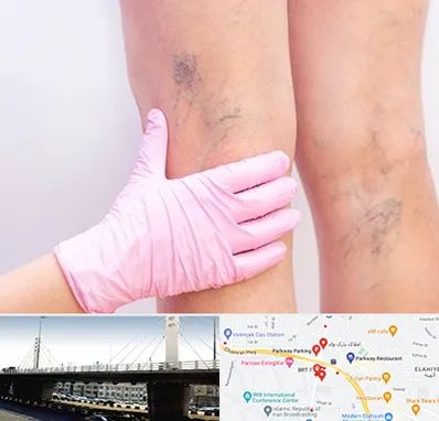 دکتر فوق تخصص واریس در پارک وی 