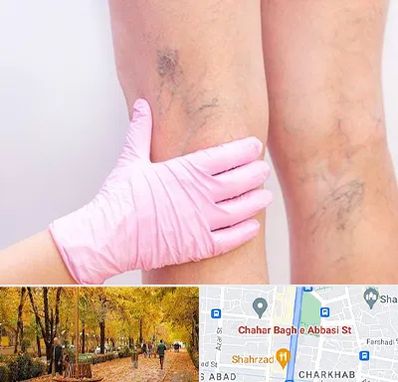 دکتر فوق تخصص واریس در چهارباغ اصفهان 