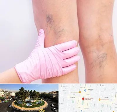 دکتر فوق تخصص واریس در هفت حوض 