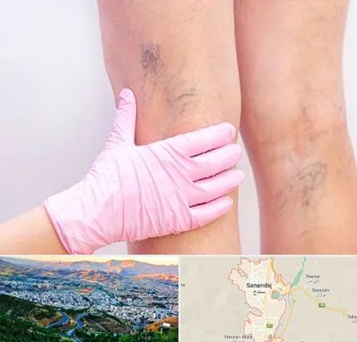 دکتر فوق تخصص واریس در سنندج