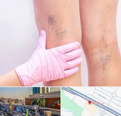 دکتر فوق تخصص واریس در لاله پارک تبریز