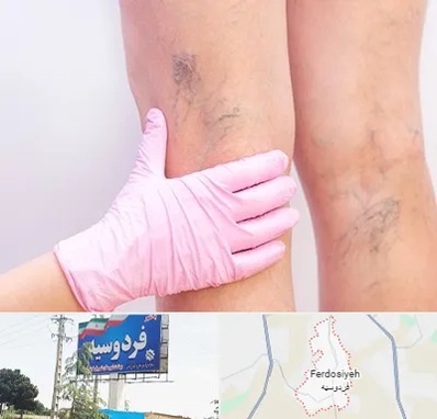 دکتر فوق تخصص واریس در فردوسیه شهریار